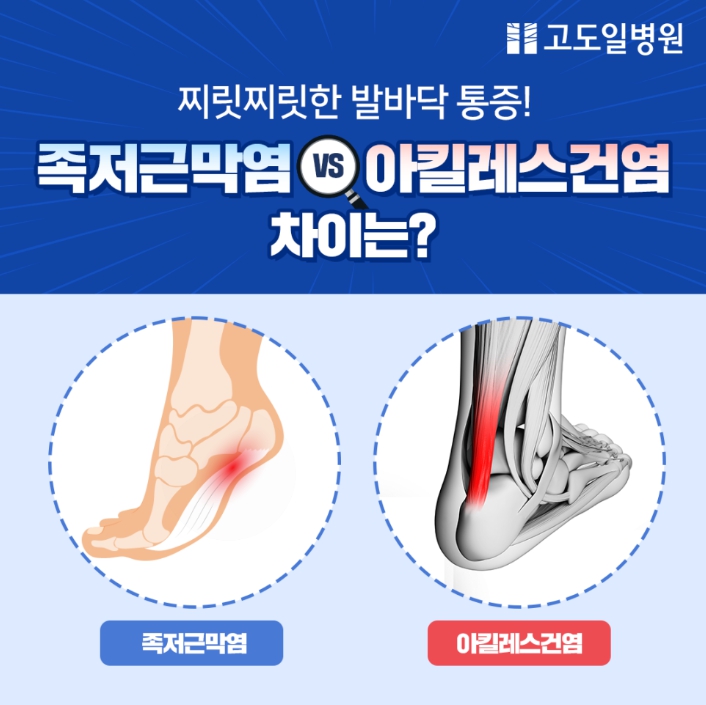 고도일병원 공식블로그