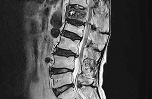 MRI 이미지