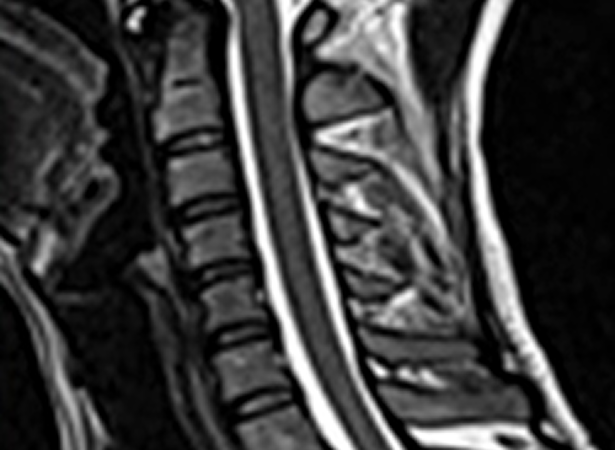 정상 MRI 이미지